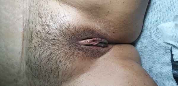 หลังตัดแต่งเสร็จ