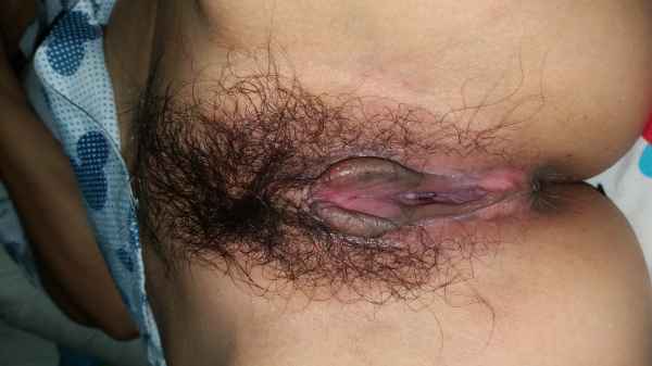 หีเมียหลังโดนเย็ดหีบวมเลย เมียบอกว่าอยากโดนซ้ำ